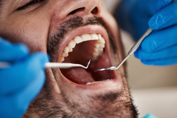 Best Walk-In Emergency Dentist in Arthurdale, WV